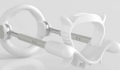 Extensor para aumentar un miembro
