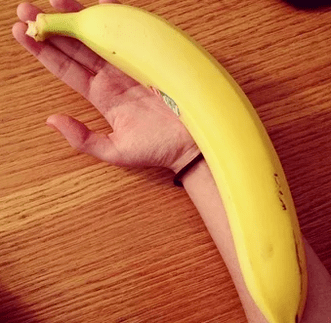 agrandamiento del pene